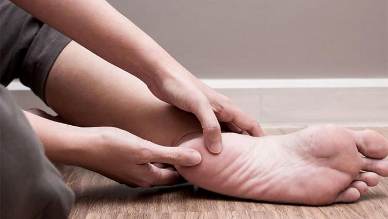 Plantar Fasciitis