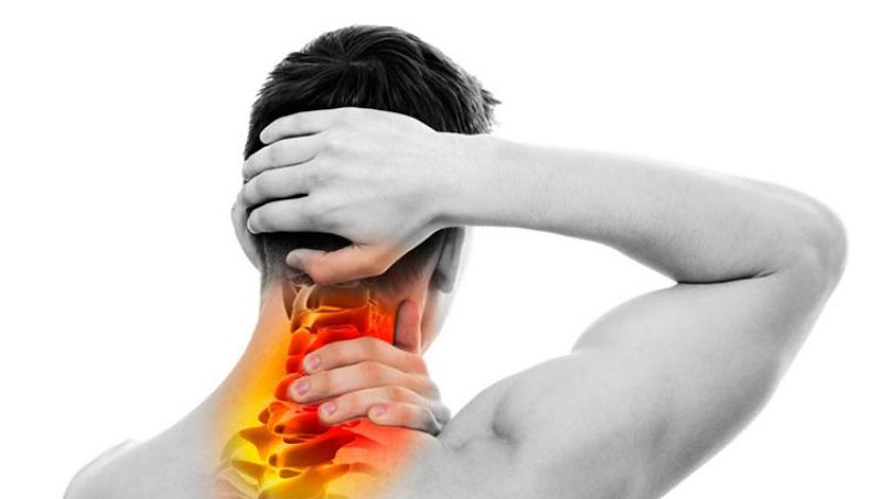 Cervical Spondylosis